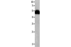 Gel: 10 % SDS-PAGE, Lysate: 40 μg, Lane: Human fetal lung tissue, Primary antibody: ABIN7190258(CHRNA3 Antibody) at dilution 1/600, Secondary antibody: Goat anti rabbit IgG at 1/8000 dilution, Exposure time: 1 minute (CHRNA3 抗体)