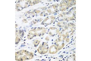 Immunohistochemistry of paraffin-embedded human stomach using HLA-DMB antibody at dilution of 1:100 (40x lens). (HLA-DMB 抗体)