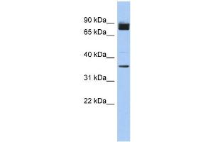 WB Suggested Anti-MGC48628 Antibody Titration: 0. (MGC48628 (N-Term) 抗体)