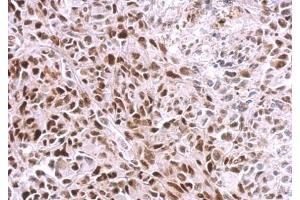 IHC-P Image SAMHD1 antibody [N2C2], Internal detects SAMHD1 protein at nucleus on SkHep1 xenograft by immunohistochemical analysis. (SAMHD1 抗体  (Internal Region))