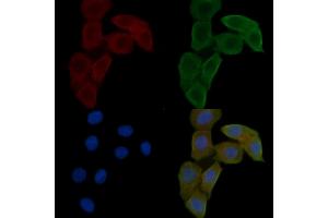 ABIN6262807 and ABIN6278585 staining Hela cells(24h of starvation treatment) by IF/ICC. (KIF20A 抗体  (C-Term))