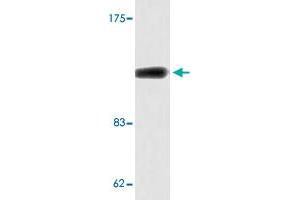 Western blot analysis of COLO 205 cell lysate with ADCY1 polyclonal antibody .