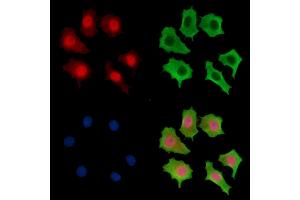 anti-Short Stature Homeobox 2 (SHOX2) antibody