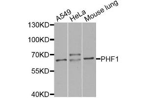 Western blot analysis of extracts of various cell lines, using PHF1 antibody (ABIN5974685) at 1/1000 dilution. (PHF1 抗体)