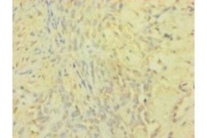 Immunohistochemistry (Paraffin-embedded Sections) (IHC (p)) image for anti-TIMP Metallopeptidase Inhibitor 1 (TIMP1) (AA 24-207) antibody (ABIN6038295)