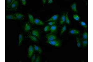 Immunofluorescence staining of Hela cells with ABIN7159545 at 1:133, counter-stained with DAPI. (MT3 抗体  (AA 1-68))