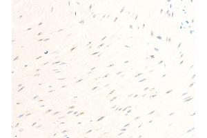 ABIN6267234 at 1/100 staining human heart tissue sections by IHC-P.