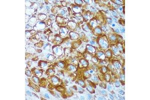 Immunohistochemistry of paraffin-embedded Human esophageal using RCE1 Rabbit pAb (ABIN7265987) at dilution of 1:100 (40x lens). (RCE1/FACE2 抗体)