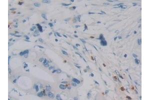 Immunohistochemistry (IHC) image for anti-Defensin, alpha 4, Corticostatin (DEFA4) (AA 23-97) antibody (ABIN7441130)