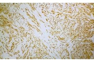 Image no. 1 for anti-Desmin (DES) antibody (ABIN335365) (Desmin 抗体)