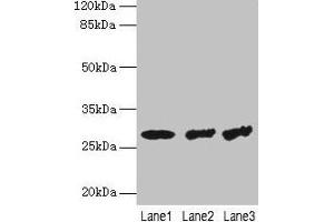 Western blot All lanes: TBCB antibody at 4 μg/mL Lane 1: Hela whole cell lysate Lane 2: A549 whole cell lysate Lane 3: Jurkat whole cell lysate Secondary Goat polyclonal to rabbit IgG at 1/10000 dilution Predicted band size: 28, 22 kDa Observed band size: 28 kDa (TBCB 抗体  (AA 1-244))