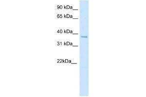 Western Blotting (WB) image for anti-Spleen Focus Forming Virus (SFFV) Proviral Integration Oncogene Spi1 (SPI1) (N-Term) antibody (ABIN925885)