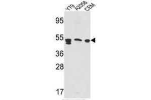 Western blot analysis of SAP Antibody (Center E300) in Y79,A2058,CEM cell line lysates(35ug/lane). (Prosaposin 抗体  (Middle Region))