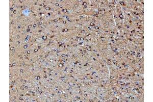 IHC analysis of PPP2CA using anti-PPP2CA antibody (ABIN3043356).