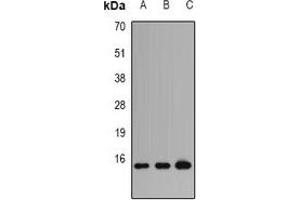 Western blot analysis of Profilin 1 expression in HT29 (A), PC12 (B), COS7 (C) whole cell lysates. (PFN1 抗体)