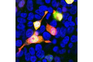 shows HEK293 cells transfected with mCherry and visualized in red. (mCherry 抗体)