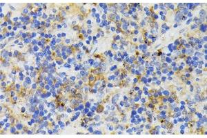 Immunohistochemistry of paraffin-embedded Mouse spleen using TREM2 Polyclonal Antibody at dilution of 1:200 (40x lens). (TREM2 抗体)