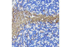 Immunohistochemistry of paraffin-embedded mouse cerebellum using CNPase Rabbit mAb (ABIN7265322) at dilution of 1:100 (40x lens). (Cnpase 抗体)