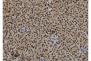 ABIN6267174 at 1/100 staining Mouse kidney tissue by IHC-P. (SF3B1 抗体  (pThr313))