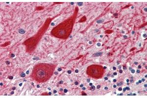 Rabbit Anti-EMX2 Antibody  Paraffin Embedded Tissue: Human Brain, cerebellum Antibody Concentration: 5 ug/ml Magnification: 400X (EMX2 抗体  (N-Term))