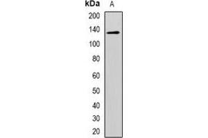 Western blot analysis of CD146 expression in Hela (A) whole cell lysates. (MCAM 抗体)