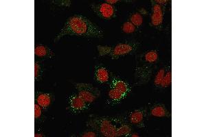 Immunofluorescence (IF) image for anti-V-Set Domain Containing T Cell Activation Inhibitor 1 (VTCN1) antibody (ABIN6940936)