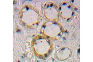 Used in DAB staining on fromalin fixed paraffin-embedded Kidney tissue (Endoglin 抗体  (AA 336-450))