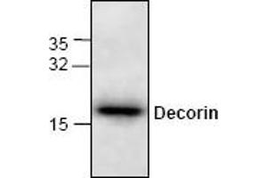 Image no. 1 for anti-Decorin (DCN) antibody (ABIN264841) (Decorin 抗体)