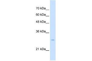 WB Suggested Anti-TSPAN32 Antibody Titration:  2. (TSPAN32 抗体  (Middle Region))