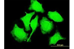 Immunofluorescence of monoclonal antibody to TCL1A on HeLa cell. (TCL1A 抗体  (AA 61-114))