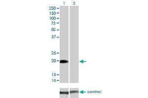 Western blot analysis of STK32A over-expressed 293 cell line, cotransfected with STK32A Validated Chimera RNAi (Lane 2) or non-transfected control (Lane 1). (STK32A 抗体  (AA 1-166))