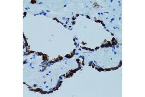 Immunohistochemistry of paraffin-embedded human lung using CTSE antibody (ABIN5971444) at dilution of 1/100 (40x lens). (Cathepsin E 抗体)