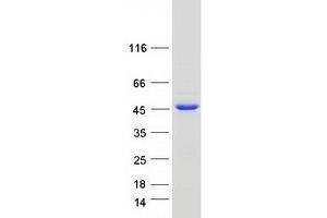 Validation with Western Blot