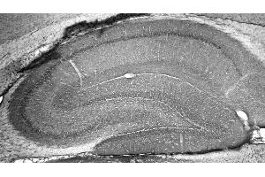 Adult rat hippocampus immunohistochemistry. (ATAD1 抗体  (AA 1-361))