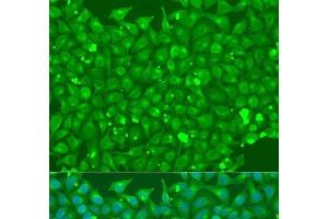 Immunofluorescence analysis of U2OS cells using FLT4 Polyclonal Antibody at dilution of 1:100. (FLT4 抗体)