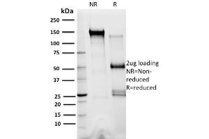 SDS-PAGE Analysis Purified XRCC3 Mouse Monoclonal Antibody (10F1/6). (XRCC3 抗体)