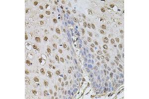 Immunohistochemistry of paraffin-embedded human esophagus using CCNA2 antibody (ABIN1871532) at dilution of 1:100 (40x lens). (Cyclin A 抗体)