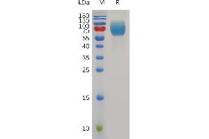 SDS-PAGE (SDS) image for CD86 (CD86) (AA 24-245) protein (Fc Tag) (ABIN7491045)