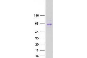 Validation with Western Blot
