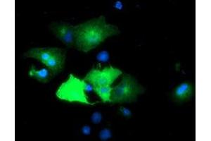 Anti-EPN2 mouse monoclonal antibody (ABIN2455555) immunofluorescent staining of COS7 cells transiently transfected by pCMV6-ENTRY EPN2 (RC213652). (Epsin 2 抗体)