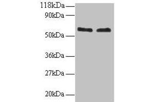Western blot All lanes: FUS antibody at 2 μg/mL Lane 1: 293T whole cell lysate Lane 2: EC109 whole cell lysate Secondary Goat polyclonal to rabbit IgG at 1/15000 dilution Predicted band size: 54 kDa Observed band size: 60 kDa (FUS 抗体  (AA 1-198))