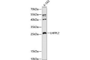 Western blot analysis of extracts of K-562 cells, using LHFPL2 antibody (ABIN6133392, ABIN6143187, ABIN6143189 and ABIN6216567) at 1:3000 dilution. (LHFPL2 抗体  (AA 30-100))
