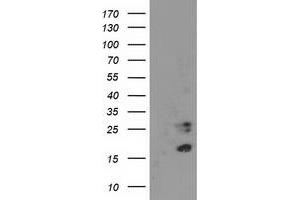 HEK293T cells were transfected with the pCMV6-ENTRY control (Left lane) or pCMV6-ENTRY CDKN3 (Right lane) cDNA for 48 hrs and lysed. (CDKN3 抗体)