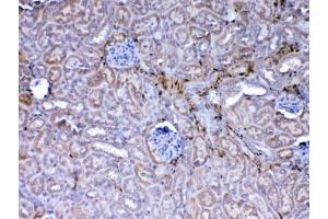 IHC testing of FFPE mouse kidney tissue with Galectin 1 antibody at 1ug/ml.