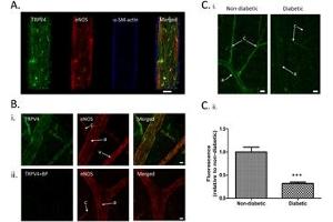 Western blot analysis of ND7/23 Mouse neuroblastoma /rat dorsal root ganglion neuron hybrid cell line lysate:1.