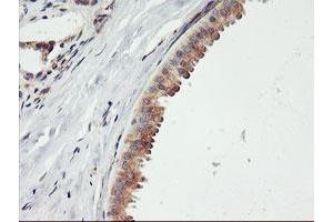 Immunohistochemical staining of paraffin-embedded Human breast tissue using anti-ENPEP mouse monoclonal antibody. (ENPEP 抗体)