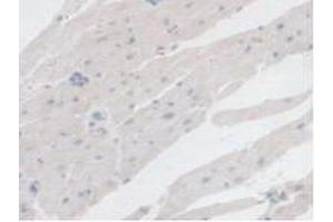 Immunohistochemistry (IHC) image for anti-Branched Chain Ketoacid Dehydrogenase Kinase (BCKDK) (AA 44-223) antibody (ABIN7436711)
