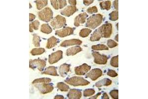 Immunohistochemistry analysis in formalin fixed and paraffin embedded human skeletal muscle reacted with hCG_1645727 Antibody (C-term) followed by peroxidase conjugation of the secondary antibody and DAB staining.