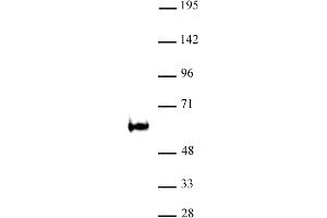 TDG / Thymine-DNA glycosylase antibody (pAb) tested by Western blot Nuclear extract of P19 cells (30 μg) probed with TDG / Thymine-DNA glycosylase antibody (1:500). (TDG 抗体)
