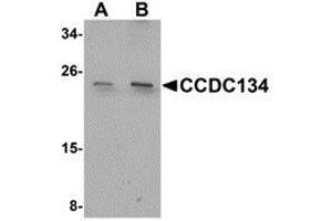 Western blot analysis of CCDC134 in rat brain tissue lysate with AP30210PU-N CCDC134 antibody at (A) 1 and (B) 2 μg/ml. (CCDC134 抗体  (N-Term))